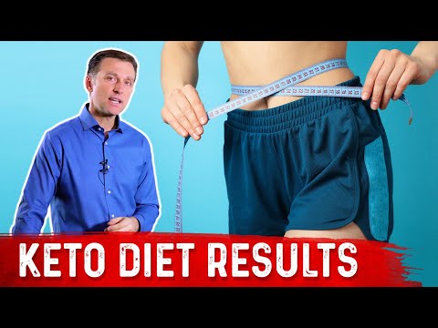 Keto Diet Results – What to Expect? – Dr. Berg