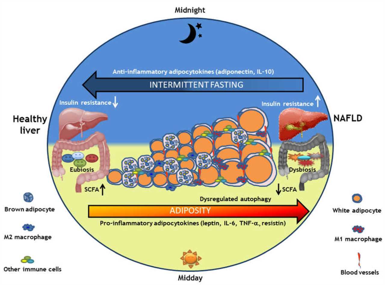 Intermittent fasting and fastingrelated headaches