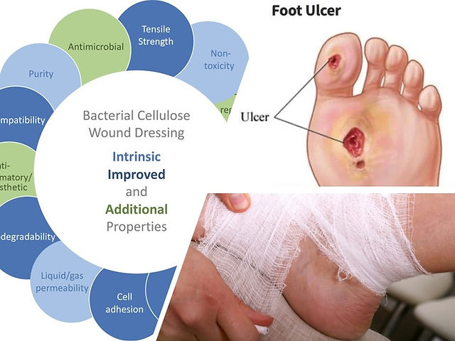 Wound healing