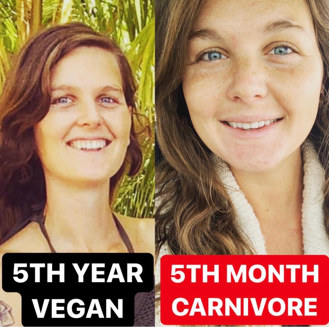 River’s Journey: From Veganism to Vitality on the Carnivore Diet