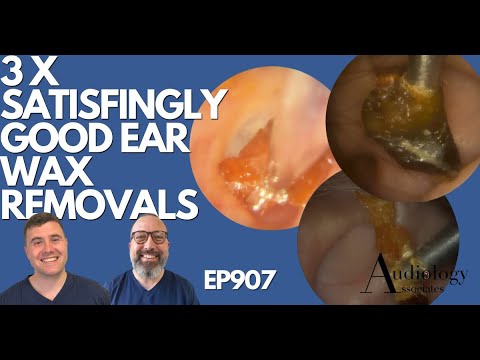 3 X SATISFYINGLY GOOD EAR WAX REMOVALS - EP907
