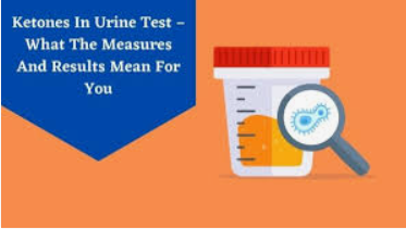 Ketones in the Urine - Are You Suffering From Ketoneuria?